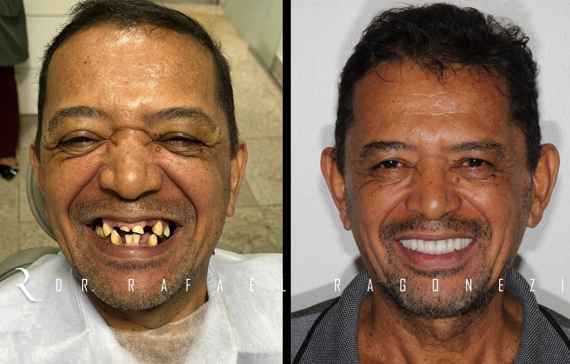 Resultado de tratamento realizado